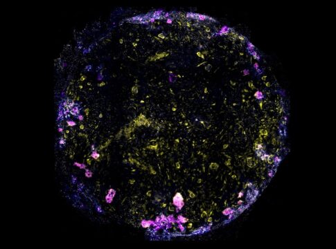 cientistas-criam-minipulmao-para-estudar-como-a-tuberculose-o-infecta