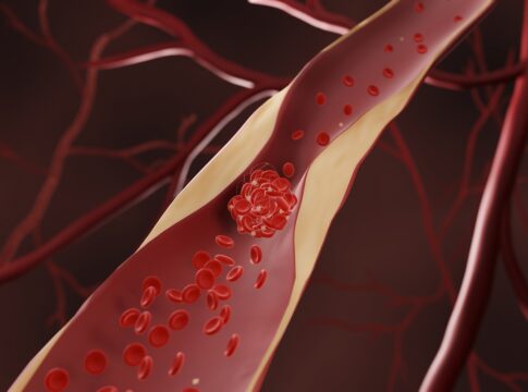 medica-vascular-cita-os-3-melhores-suplementos-beneficos-a-circulacao