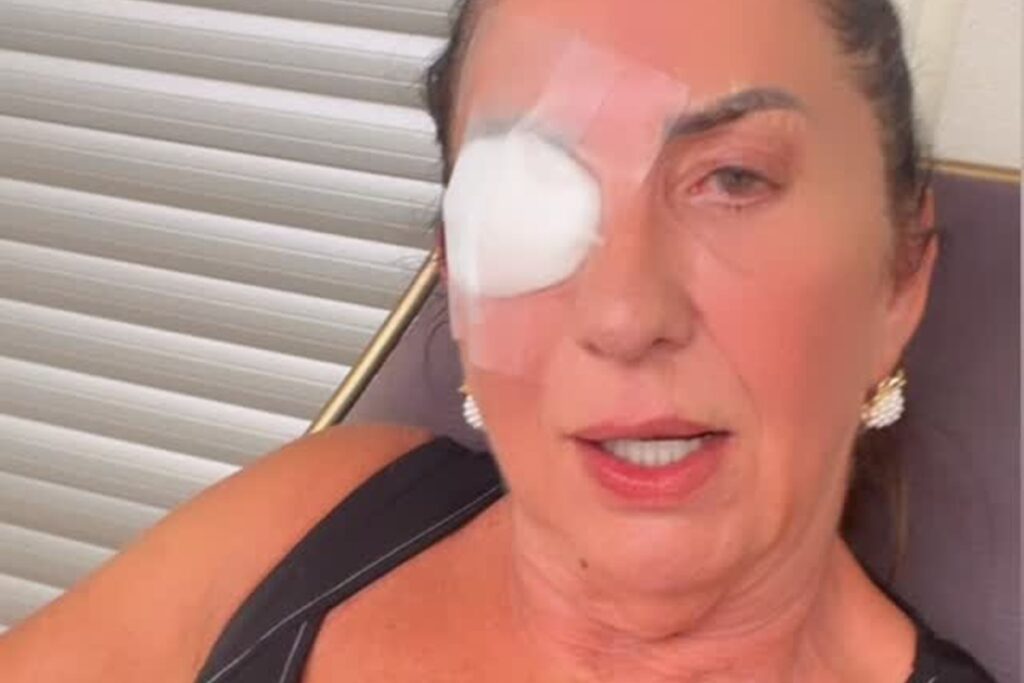 mae-de-virginia-surge-com-curativo-no-olho-e-fala-sobre-sumico-da-web.-video