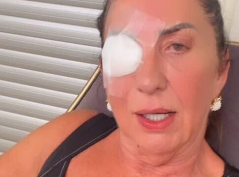 mae-de-virginia-surge-com-curativo-no-olho-e-fala-sobre-sumico-da-web.-video