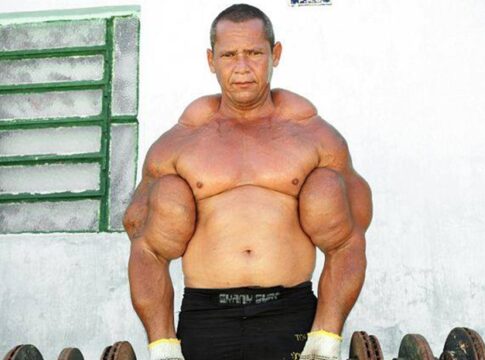 quem-era-arlindo-anomalia,-o-popeye-brasileiro-que-morreu-aos-55-anos