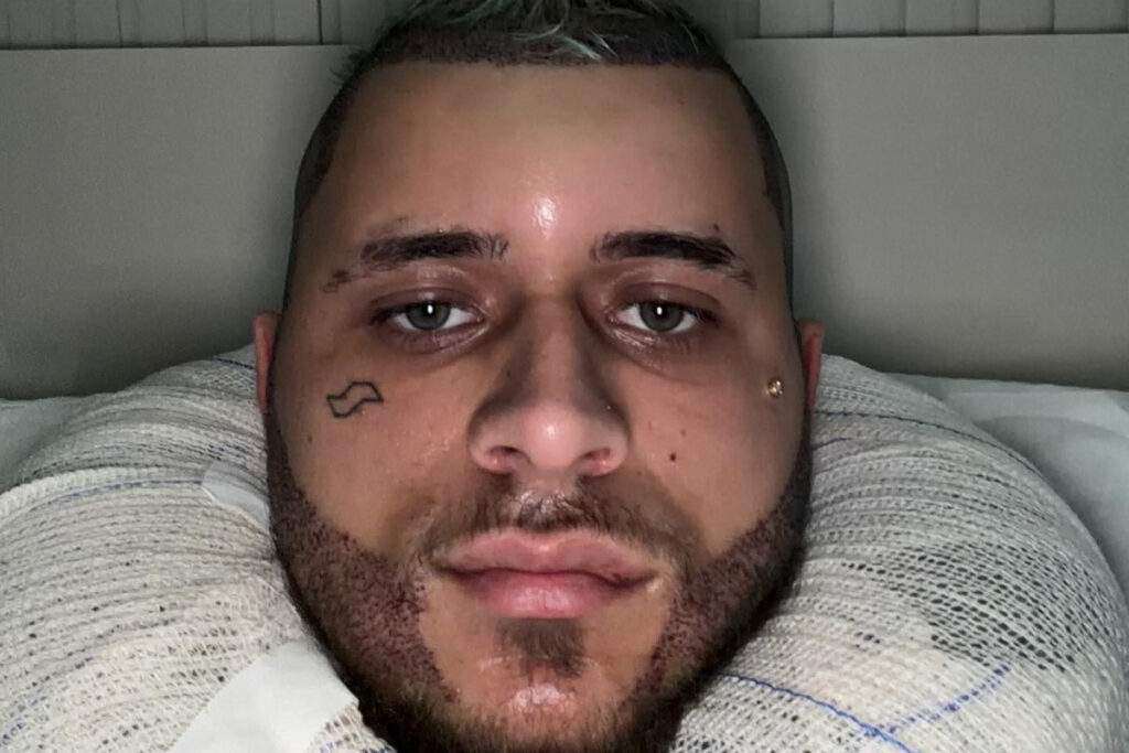 saiba-por-que-mc-pedrinho-apareceu-com-rosto-irreconhecivel