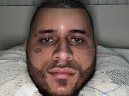 saiba-por-que-mc-pedrinho-apareceu-com-rosto-irreconhecivel