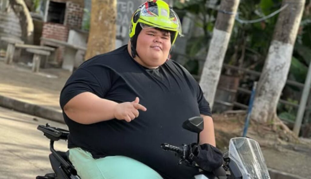 gordao-da-xj-perde-130-kg-e-reavalia-bariatrica:-veja-antes-e-depois