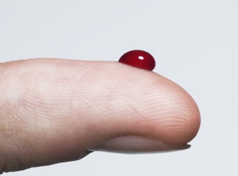 picos-de-glicose-em-pessoas-com-diabetes-aumentam-risco-de-alzheimer