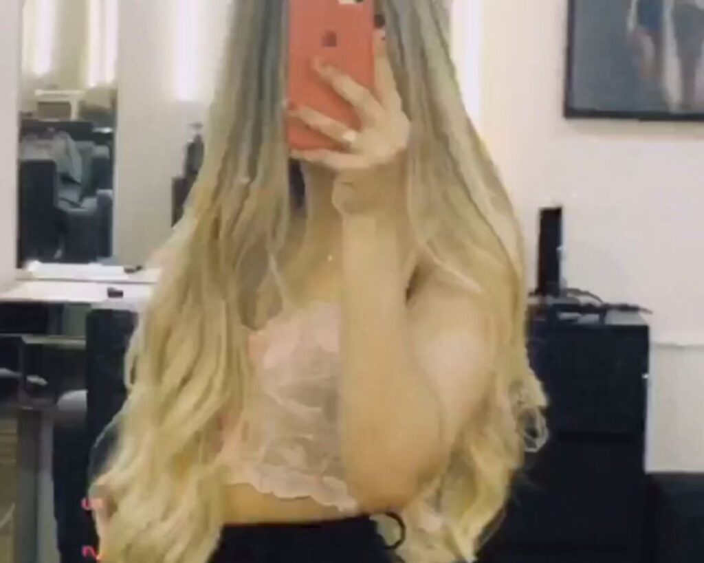 gravida-e-feliz:-a-volta-por-cima-da-jovem-escalpelada-em-kart-do-df