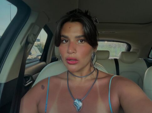 dermatilomania:-medica-revela-o-que-agrava-transtorno-de-giulia-costa