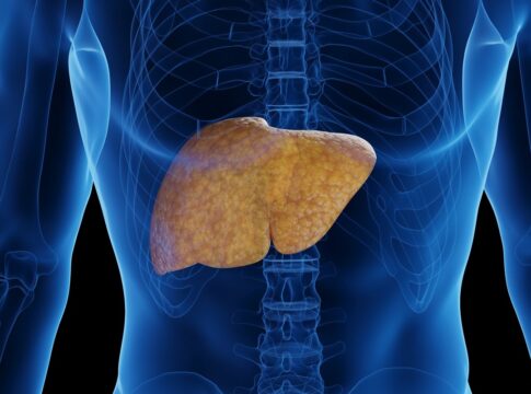 nutricionista-diz-quais-alimentos-ajudam-a-reduzir-a-gordura-no-figado