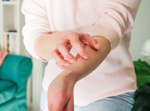 alem-de-giulia-costa:-veja-outras-famosas-que-possuem-dermatilomania