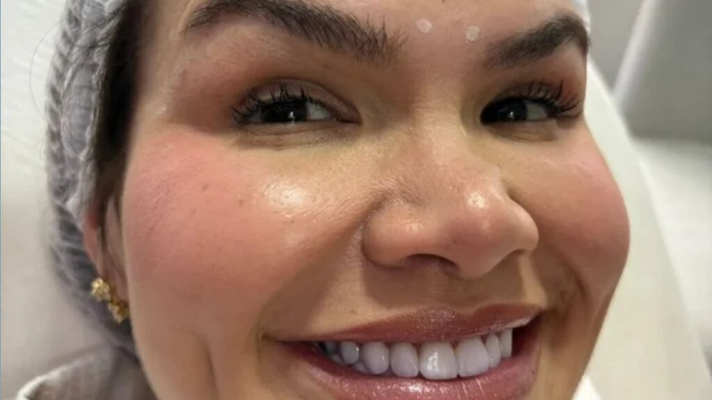 saiba-qual-procedimento-thais-carla-fez-no-rosto-apos-perder-80-kg