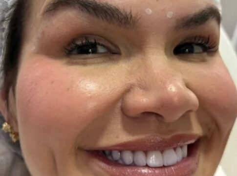 saiba-qual-procedimento-thais-carla-fez-no-rosto-apos-perder-80-kg