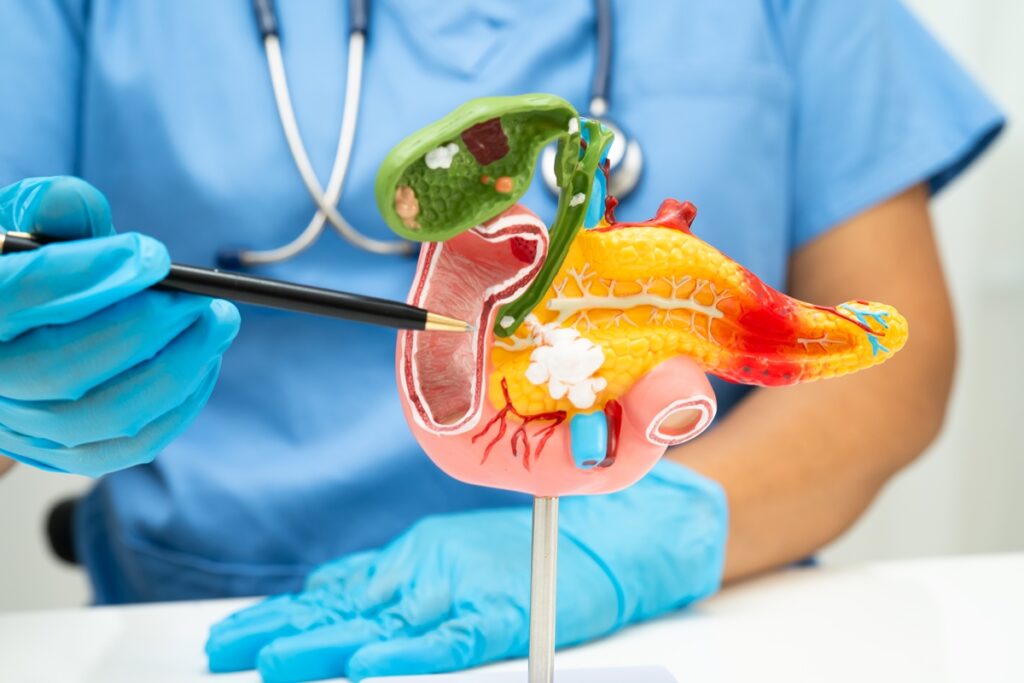 nova-descoberta-da-esperanca-para-o-tratamento-de-cancer-de-pancreas