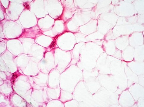 gordura-bege-pode-melhorar-funcao-vascular-e-pressao,-indica-estudo
