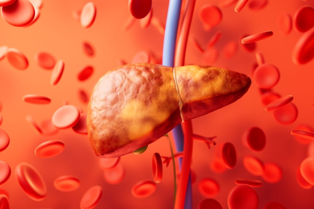 hepatologista-explica-o-que-mais-tende-a-provocar-o-colapso-do-figado