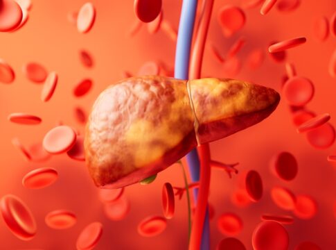 hepatologista-explica-o-que-mais-tende-a-provocar-o-colapso-do-figado