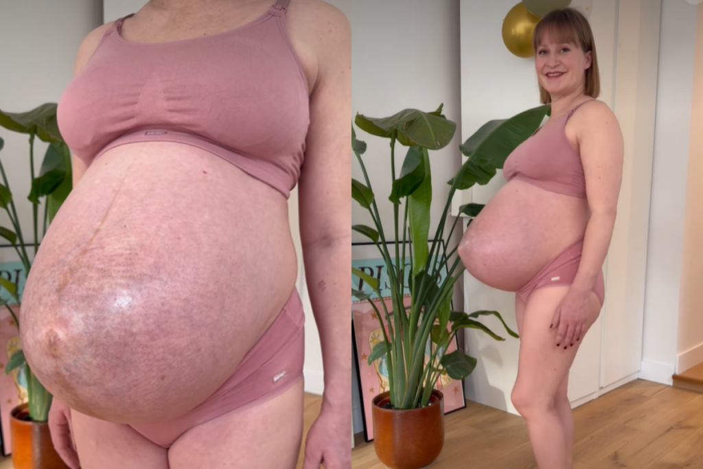 gravida-de-trigemeos-causa-espanto-com-formato-de-barriga-pontuda