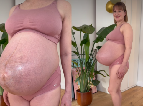 gravida-de-trigemeos-causa-espanto-com-formato-de-barriga-pontuda