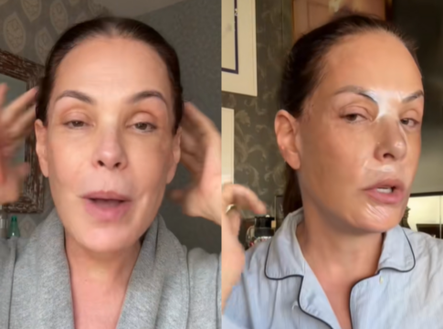 o-“botox-natural”-que-faz-carolina-ferraz-ter-a-pele-linda-aos-58-anos