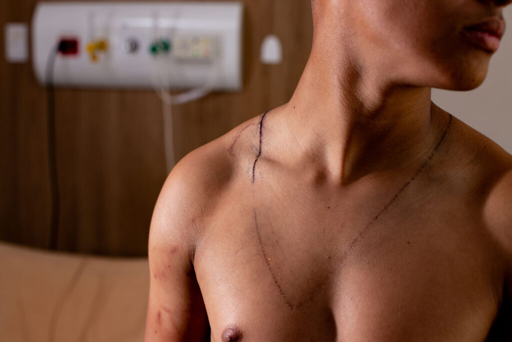 jovem-atingido-por-raio-em-ato-de-nikolas-teve-hemorragia-no-ouvido