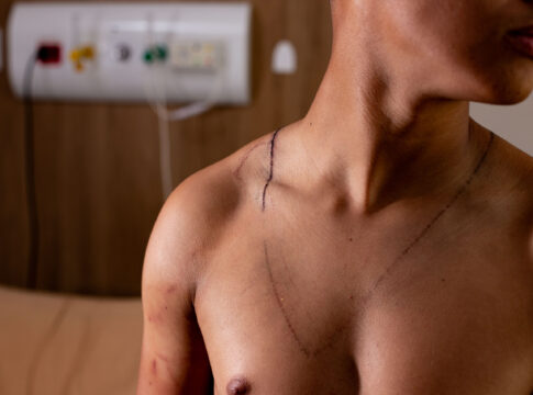 jovem-atingido-por-raio-em-ato-de-nikolas-teve-hemorragia-no-ouvido