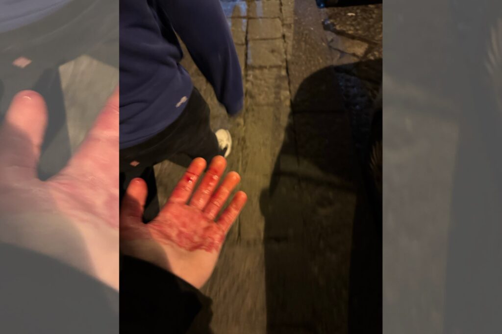 torcedores-do-chelsea-sao-esfaqueados-antes-de-jogo-em-napoles