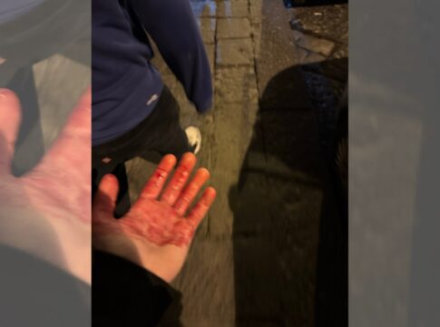 torcedores-do-chelsea-sao-esfaqueados-antes-de-jogo-em-napoles