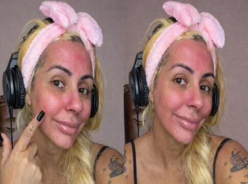 influencer-sofre-alergia-apos-passar-sangue-menstrual-no-rosto
