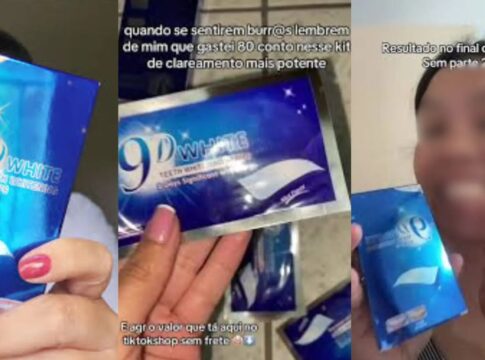 fita-para-clareamento-dental-viraliza-no-tiktok-e-levanta-alerta-sobre-riscos