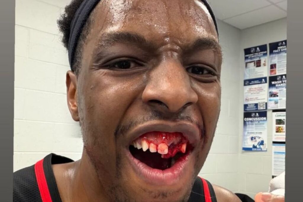 nba:-cotovelada-de-astro-dos-celtics-faz-okongwu-perder-dente.-veja-video