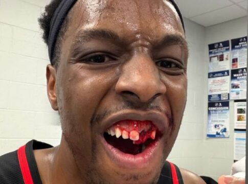 nba:-cotovelada-de-astro-dos-celtics-faz-okongwu-perder-dente.-veja-video