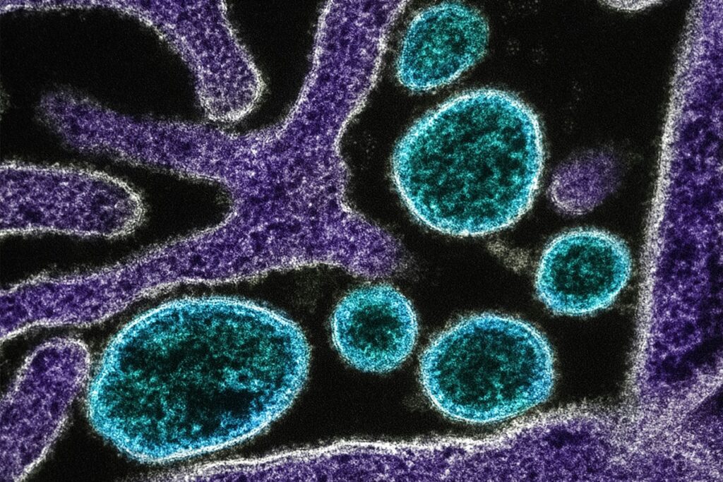 nipah:-especialista-explica-potencial-pandemico-do-virus