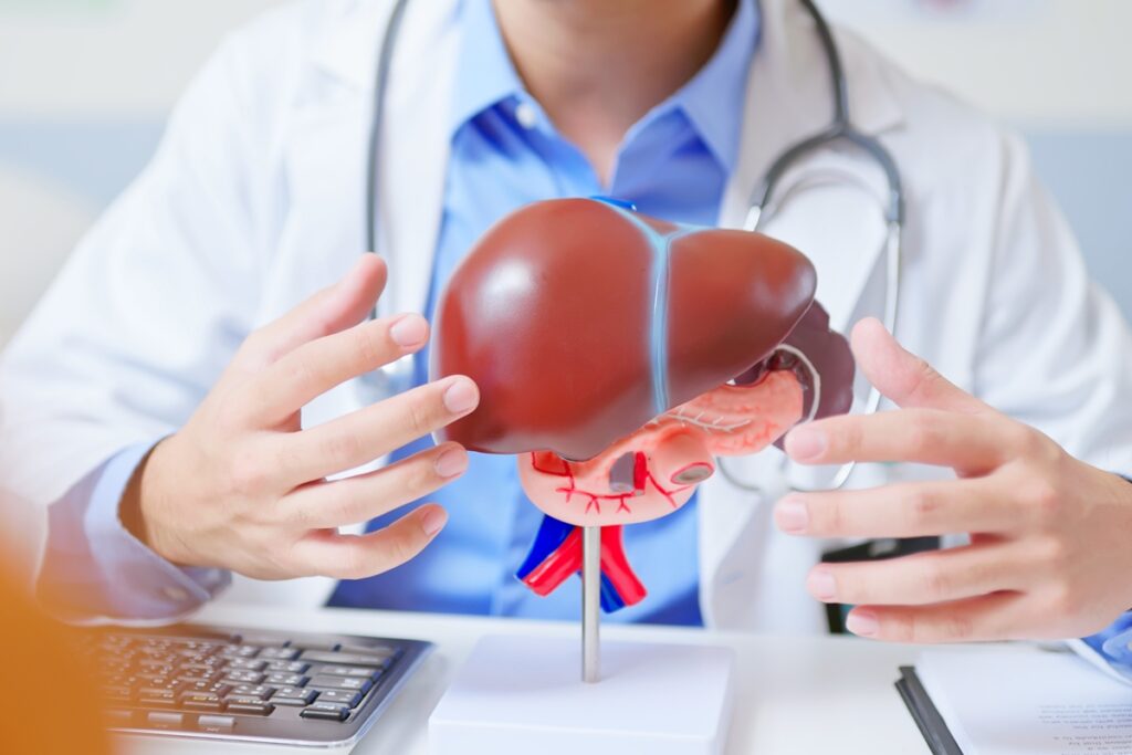 hepatologista-revela-guia-completo-para-evitar-gordura-no-figado