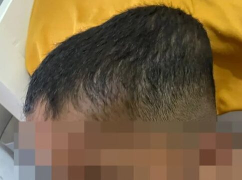 baba-e-denunciada-por-agressao-contra-crianca-autista-em-alagoas