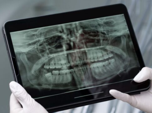 usp:-saliva-artificial-ajuda-a-proteger-dentes-de-pacientes-com-cancer