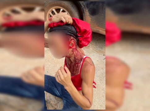 mulher-trans-e-brutalmente-agredida-com-barra-de-ferro-por-homem-no-df