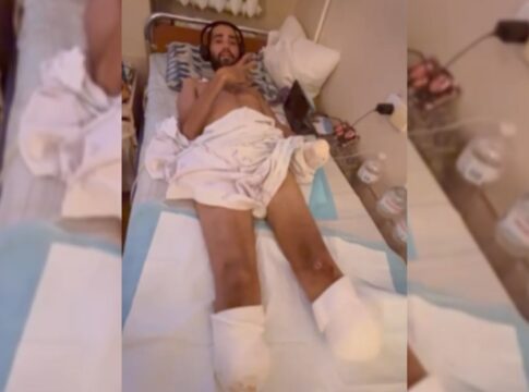 “nao-e-uma-guerra-convencional”,-diz-brasileiro-amputado-na-ucrania