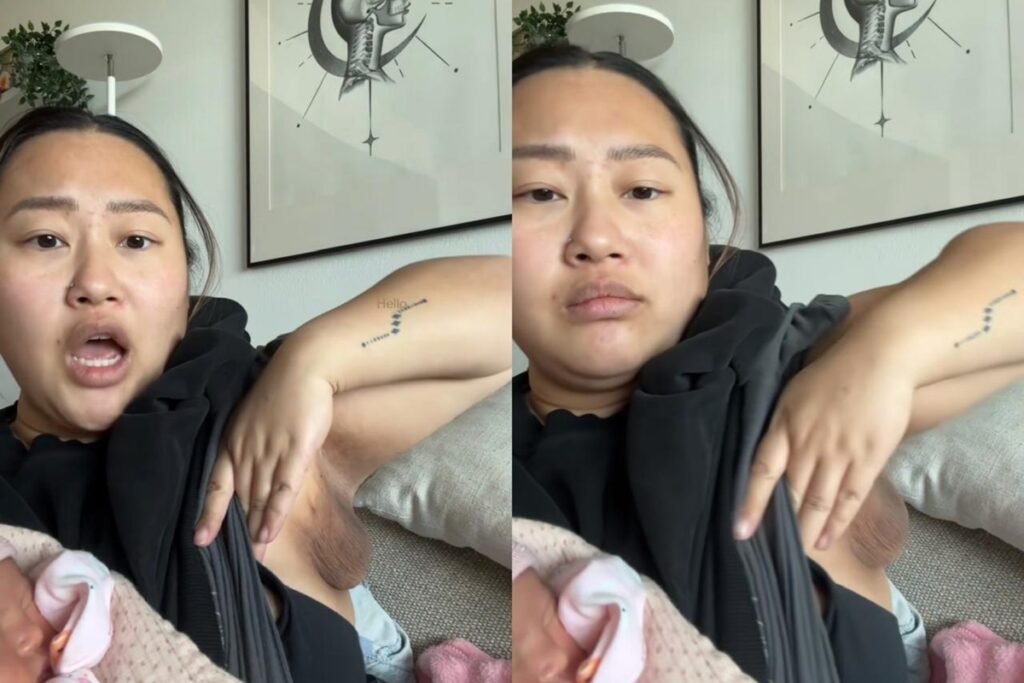 apos-dar-a-luz,-mulher-desenvolve-terceiro-seio-em-lugar-inesperado.-veja-video