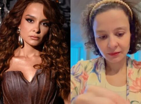 alopecia-androgenetica:-caso-da-cantora-maiara-levanta-alerta