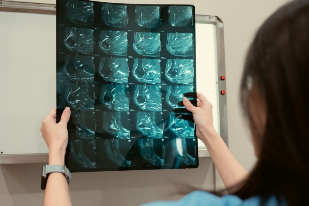 oncologista-conta-5-crencas-sobre-o-cancer-que-atrapalham-o-tratamento