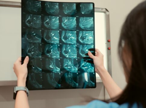 oncologista-conta-5-crencas-sobre-o-cancer-que-atrapalham-o-tratamento