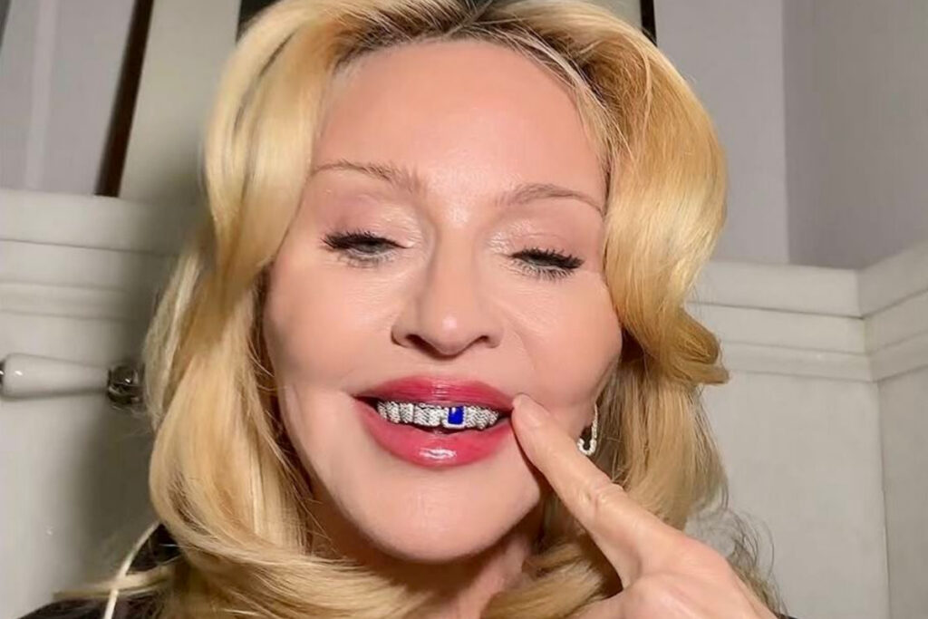 saiba-o-valor-da-joia-dental-usada-por-madonna.-video