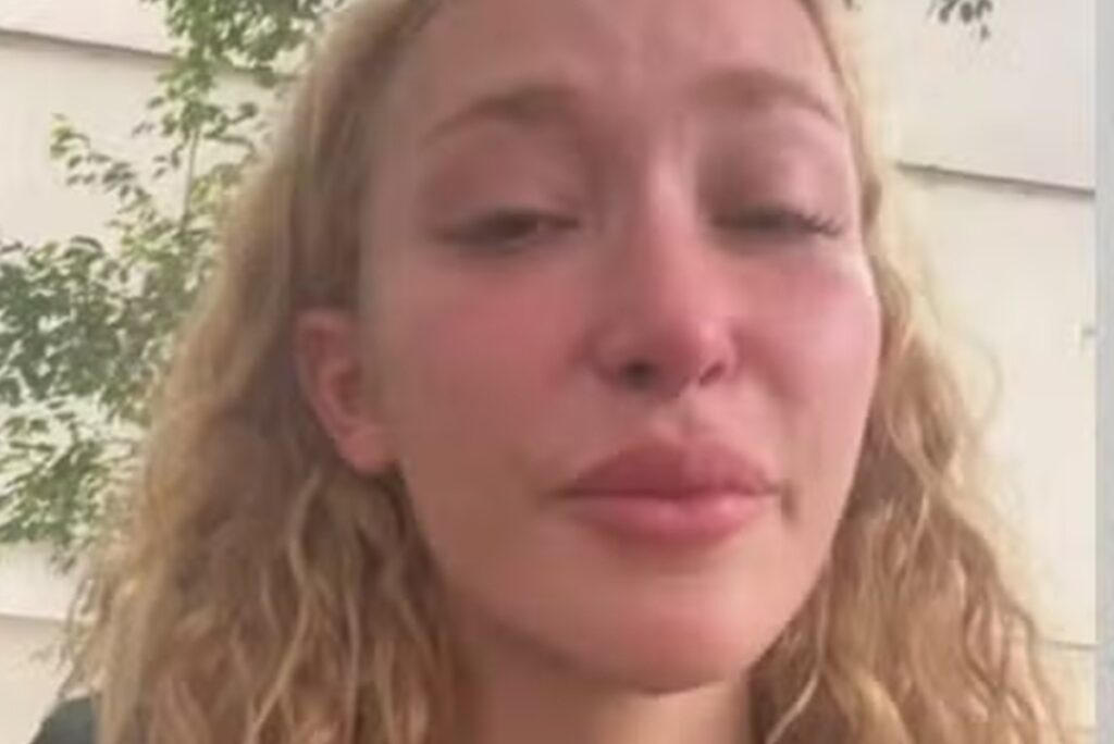 atriz-de-verdades-secretas-e-roubada-e-agredida-no-rio-de-janeiro