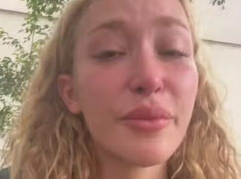 atriz-de-verdades-secretas-e-roubada-e-agredida-no-rio-de-janeiro