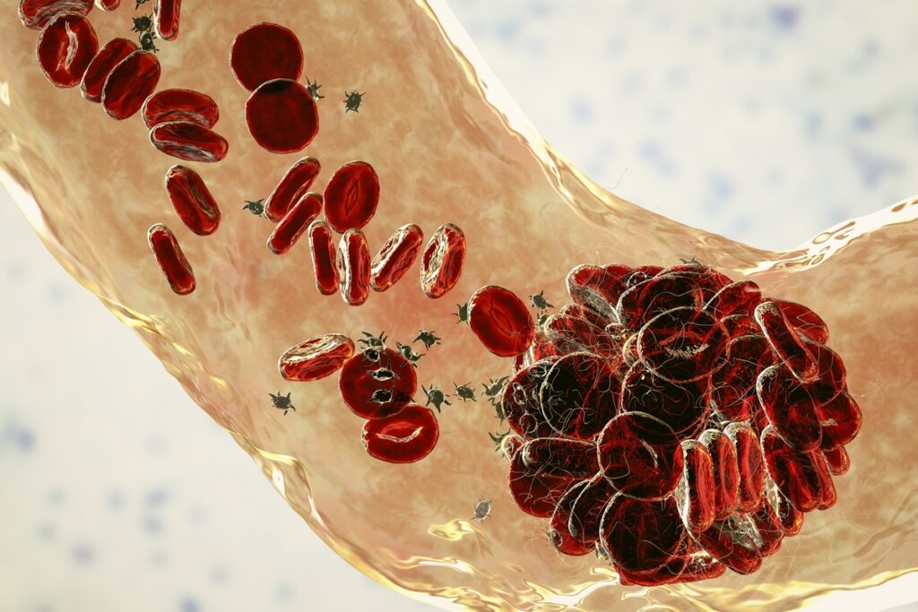 hpv:-sangue-menstrual-pode-ajudar-a-detectar-cancer-do-colo-do-utero