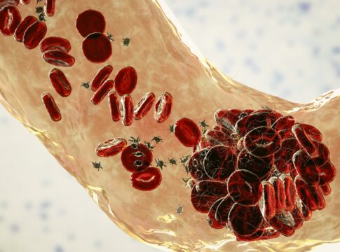 hpv:-sangue-menstrual-pode-ajudar-a-detectar-cancer-do-colo-do-utero