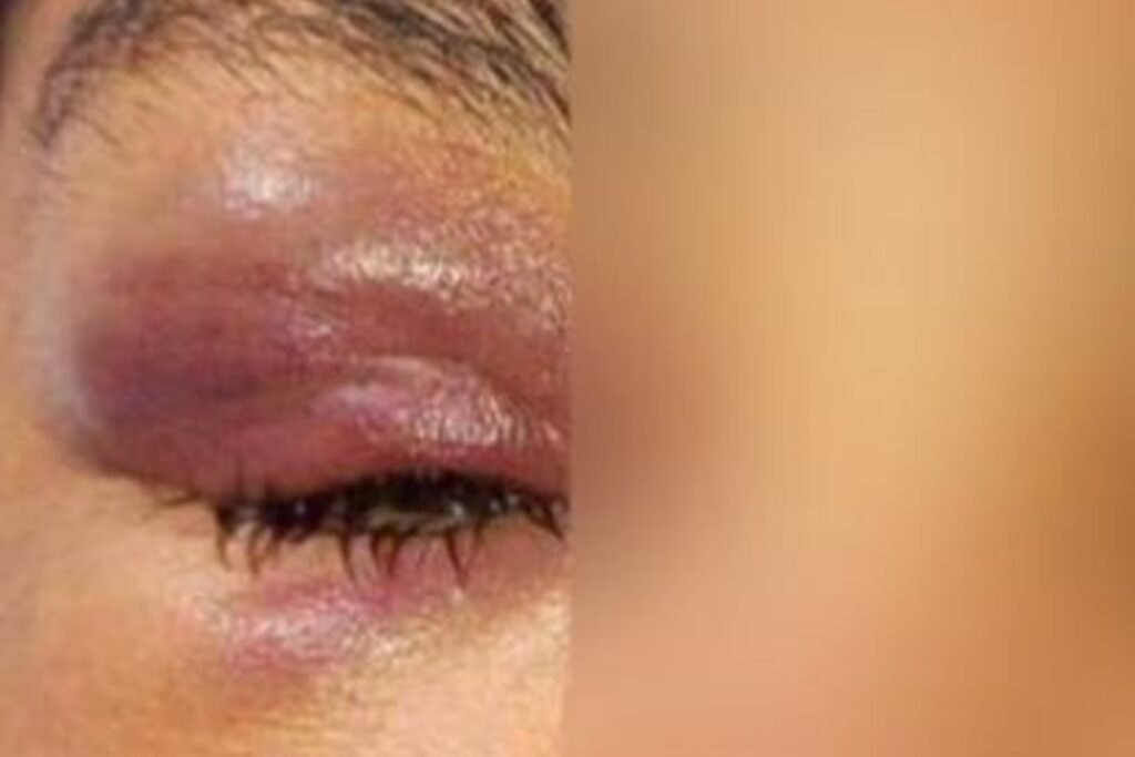 suspeito-de-torturar-e-espancar-mulher-com-corrente-de-ferro-e-preso