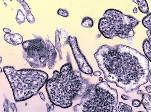 brasil-nao-tem-caso-de-nipah-confirmado,-esclarece-ministerio-da-saude