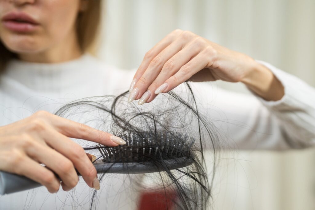 dermatologista-conta-5-sinais-de-alerta-de-que-a-queda-de-cabelo-e-seria