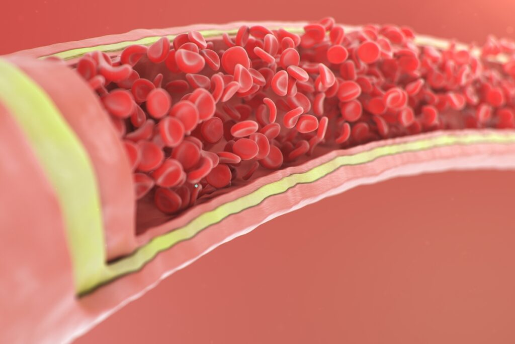 medico-vascular-aponta-sinais-de-alerta-da-calcificacao-das-arterias