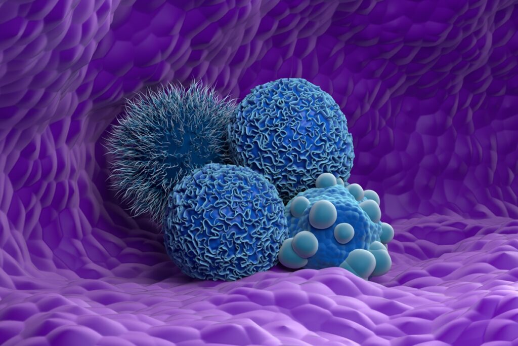 gastroenterologista-lista-os-principais-sintomas-do-cancer-de-pancreas